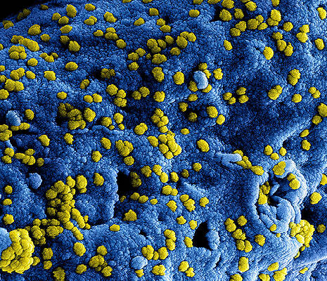 Wall Art - Photograph - Mers Coronavirus Particles, Sem #1 by Science Source