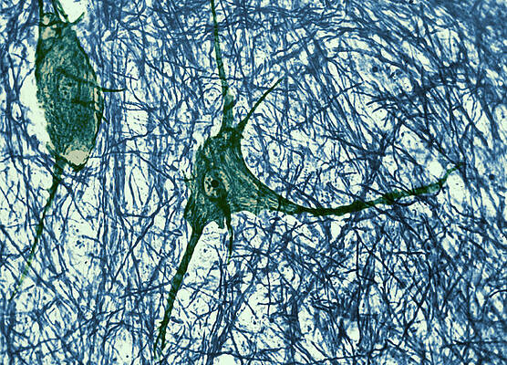 Wall Art - Photograph - Motor Neuron, Cat Spinal Cord #1 by Omikron