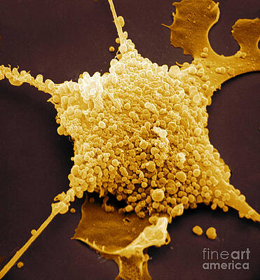 Wall Art - Photograph - Mycoplasma, Sem #1 by David M. Phillips