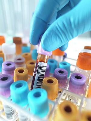 Wall Art - Photograph - Person Selecting A Blood Sample #1 by Science Photo Library