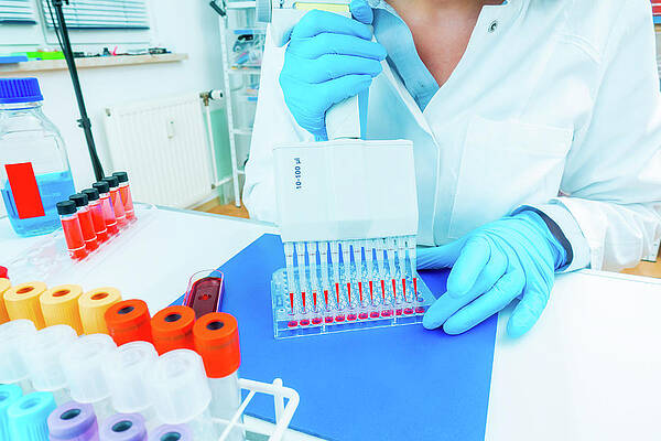 Micropipette Art - Fine Art America