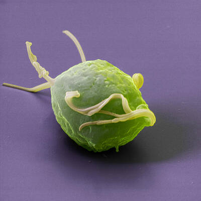 Wall Art - Photograph - Trichomonas Vaginalis #1 by Eye of Science