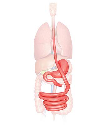Wall Art - Photograph - Gastric Bypass #19 by Science Photo Library