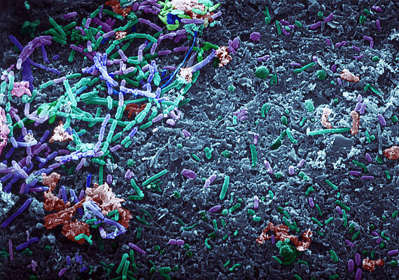 Wall Art - Photograph - Bacteria In Raw Sewage Sem #2 by Science Source