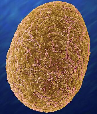Wall Art - Photograph - Box Jellyfish Larva Stage (carybdea Alata) #2 by Science Photo Library