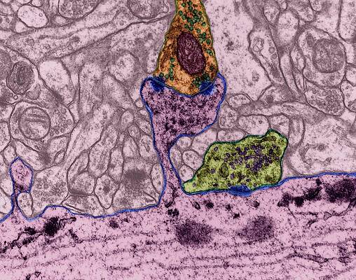 Wall Art - Photograph - Dendritic Spine With Excitatory Synapse #2 by Science Photo Library