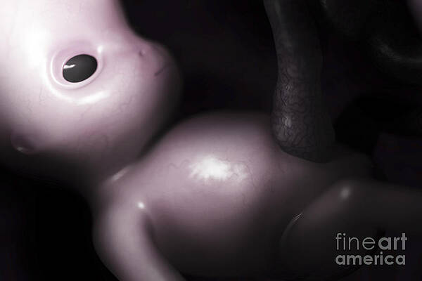 Wall Art - Photograph - Developing Fetus Week10 #2 by Science Picture Co