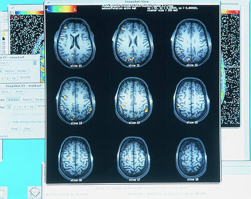Wall Art - Photograph - Eeg Of Brain Activity During Mathematical Thought #2 by Science Photo Library