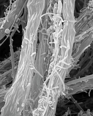 Wall Art - Photograph - Filamentous Iron Oxidizing Bacterium #2 by Science Photo Library