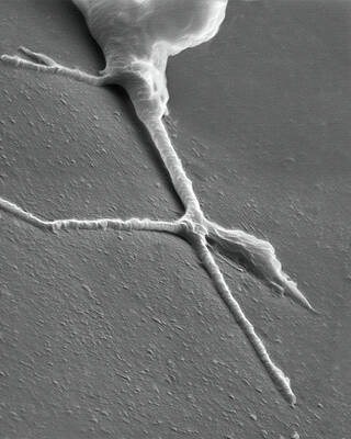 Wall Art - Photograph - Growth Cone From A Developing Neuron #2 by Science Photo Library