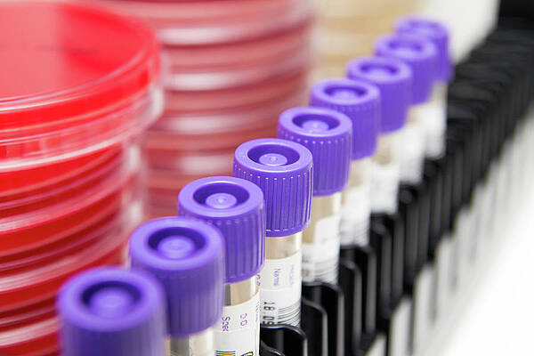 Wall Art - Photograph - Microbial Sample Transport Swabs #2 by Science Photo Library
