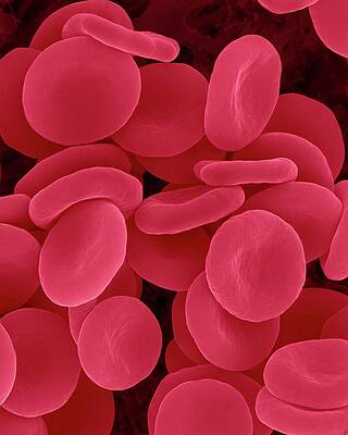 Wall Art - Photograph - Red Blood Cells In Isotonic Solution #2 by Science Photo Library