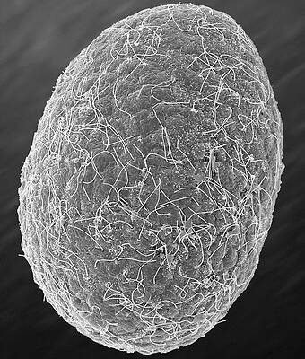 Wall Art - Photograph - Box Jellyfish Larva Stage (carybdea Alata) #3 by Science Photo Library