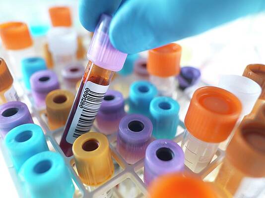 Wall Art - Photograph - Person Selecting A Blood Sample #3 by Science Photo Library