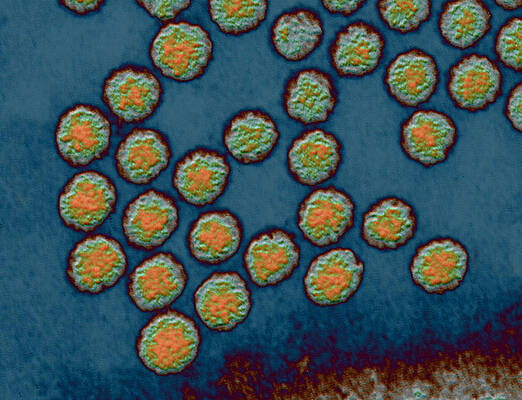 Wall Art - Photograph - Polio Viruses #3 by Eye of Science