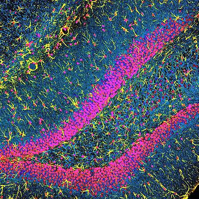 Wall Art - Photograph - Brain Cells #4 by Science Photo Library