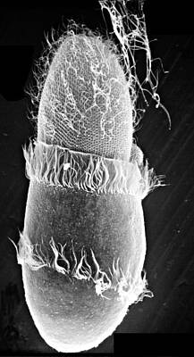 Wall Art - Photograph - Didinium Attacking Paramecium, Sem #4 by Greg Antipa