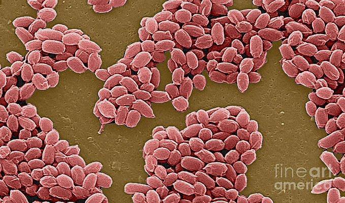 Wall Art - Photograph - Anthrax Bacteria Sem #5 by Science Source