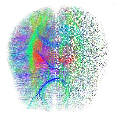 Wall Art - Photograph - Brain White Matter Fibres Dissolving #5 by Science Photo Library