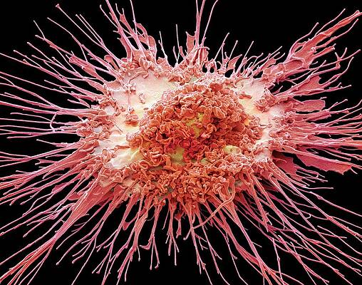 Wall Art - Photograph - Dendritic Cell #6 by Science Photo Library