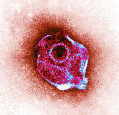 Wall Art - Photograph - Herpes Simplex Virus, Tem #8 by ASM/Science Source