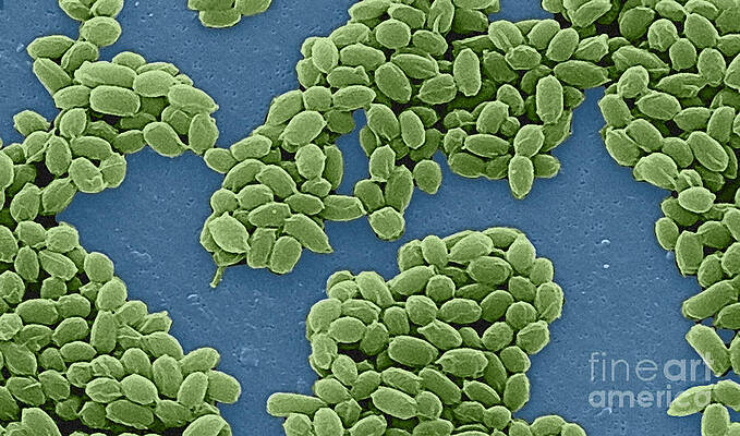 Wall Art - Photograph - Anthrax Bacteria Sem #9 by Science Source