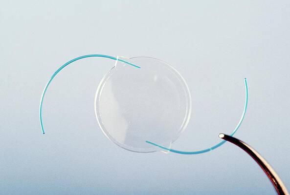Wall Art - Photograph - Artificial Eye Lens by Science Photo Library