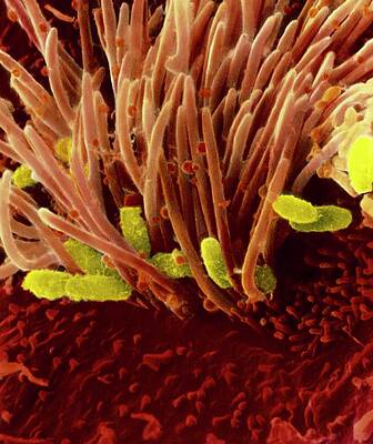 Wall Art - Photograph - Bordetella Pertussis Bacteria In Trachea by Science Photo Library