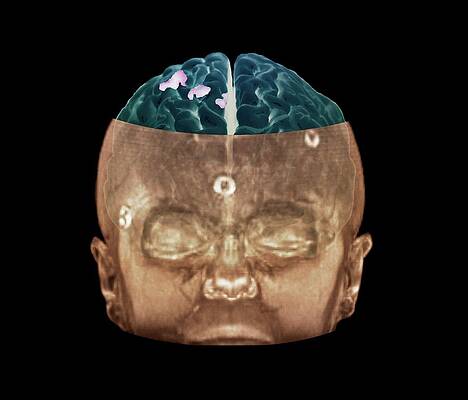 Wall Art - Photograph - Brain Activity by Science Photo Library