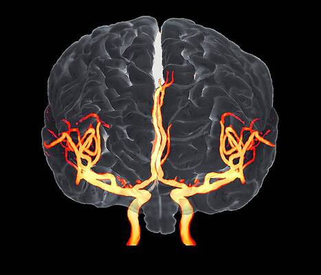 Mind Blown The Surprising Reason Arteries Are Organs - nhfc4r5