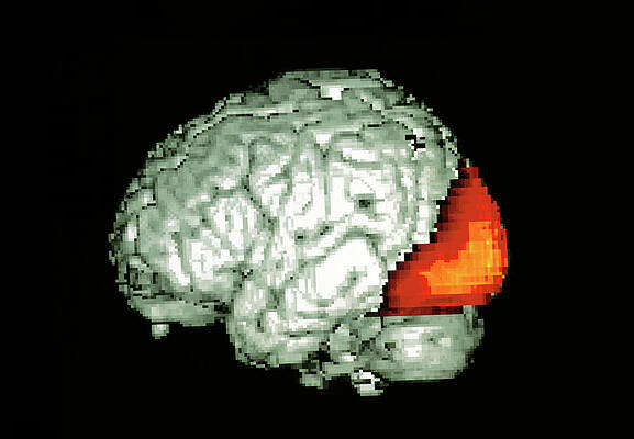 Wall Art - Photograph - Brain Viewing Images by Science Photo Library