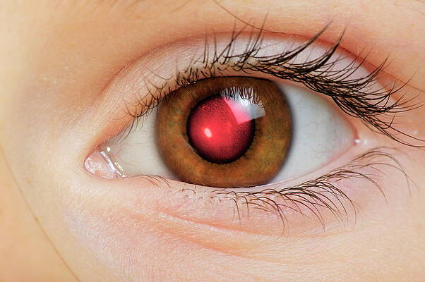 Wall Art - Photograph - Camera Flash Red-eye by Science Photo Library