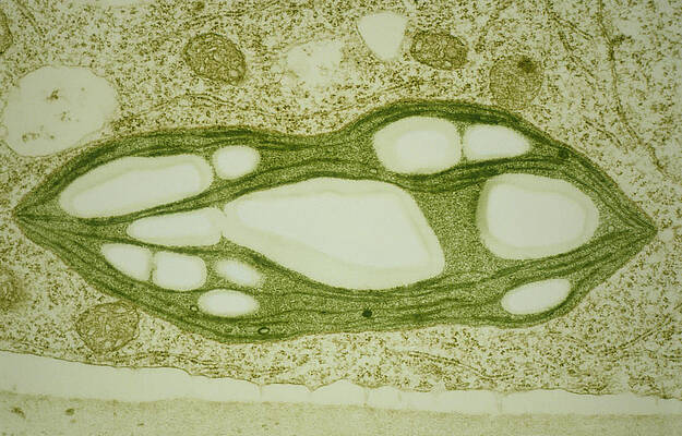 Wall Art - Photograph - Chloroplast In Protonema Of Moss by Science Photo Library