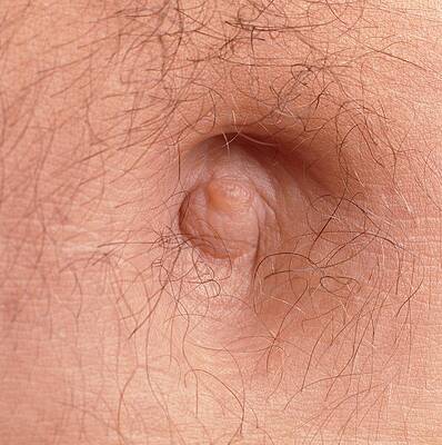 Wall Art - Photograph - Close-up Of The Navel (belly Button) Of A Man by Science Photo Library