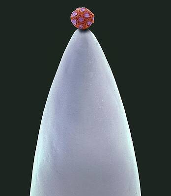 Wall Art - Photograph - Coccolithophore On Needle Tip by Science Photo Library