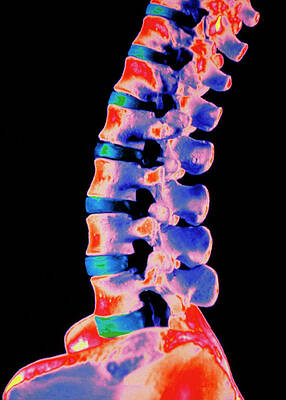 Wall Art - Photograph - Coloured 3-d Ct Scan Of Lower Spine by Science Photo Library