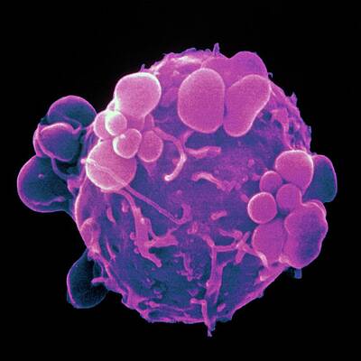 Wall Art - Photograph - Coloured Sem Of Induced Apoptosis In Cancer Cell by Science Photo Library