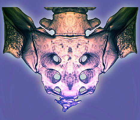 Wall Art - Photograph - Compressed Spine by Science Photo Library