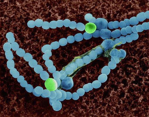Wall Art - Photograph - Cyanobacterium (anabaena Sp.) by Science Photo Library