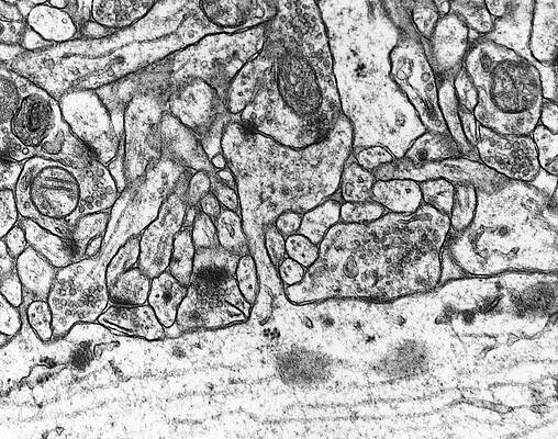 Wall Art - Photograph - Dendritic Spine With Excitatory Synapse by Science Photo Library