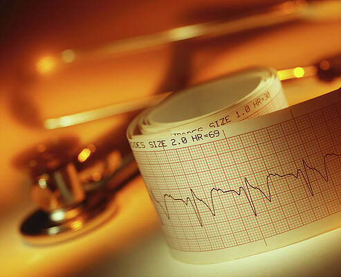 Wall Art - Photograph - Ecg And Stethoscope by Science Photo Library