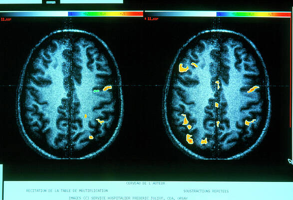 Wall Art - Photograph - Eeg Of Brain Activity During Mathematical Thought by Science Photo Library