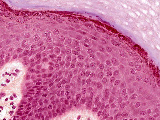 Wall Art - Photograph - Epidermis Lm by Alvin Telser
