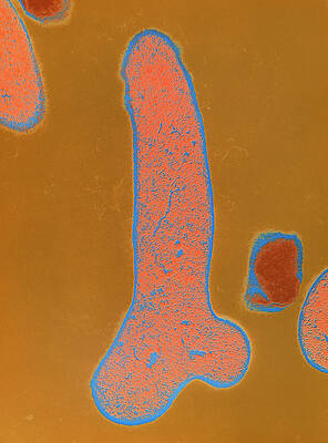Wall Art - Photograph - False-col Tem Of Bifidobacterium Bifidum by Science Photo Library