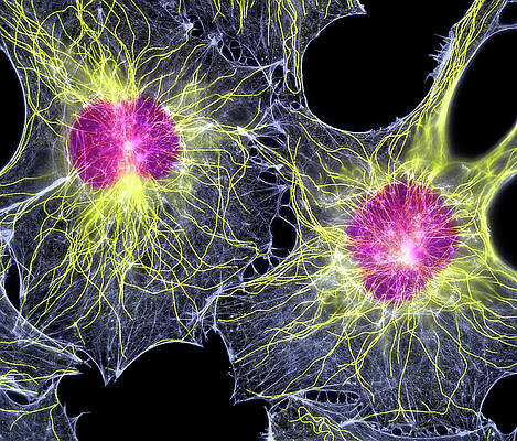 Wall Art - Photograph - Fibroblast Cells Showing Cytoskeleton by Science Photo Library