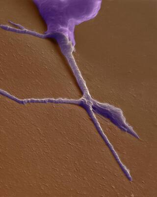 Wall Art - Photograph - Growth Cone From A Developing Neuron by Science Photo Library