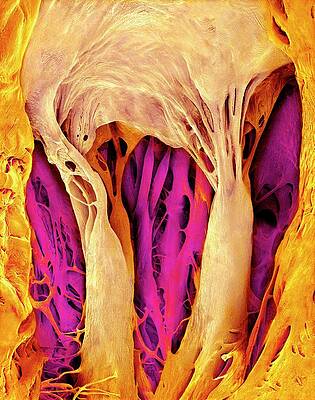 Wall Art - Photograph - Heart Valve And Strings by Science Photo Library