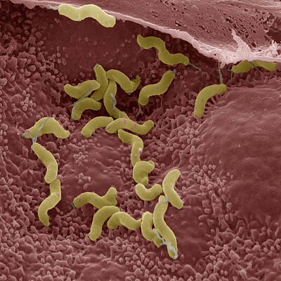 Wall Art - Photograph - Helicobacter Pylori by Eye of Science