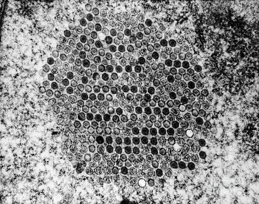 Wall Art - Photograph - Herpes Simplex Virus 2 by David M. Phillips