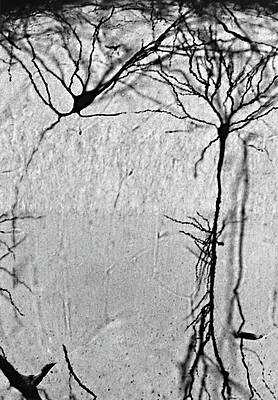 Wall Art - Photograph - Hippocampus Interneuron And Pyramidal Neuron by Science Photo Library